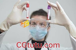医生在实验室比较COVID-19阳性患者血样新型冠状病毒肺炎实拍视频素材
